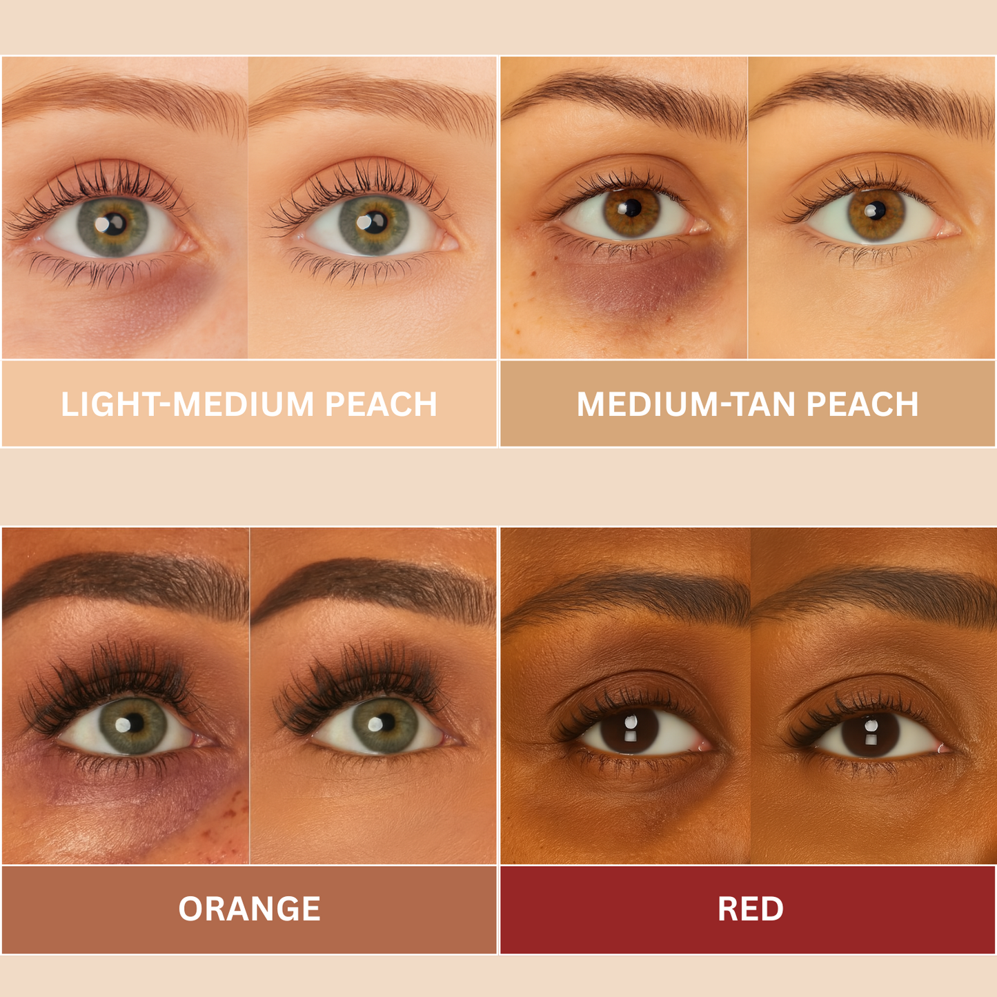 Severa™ Radiant Eye Corrector