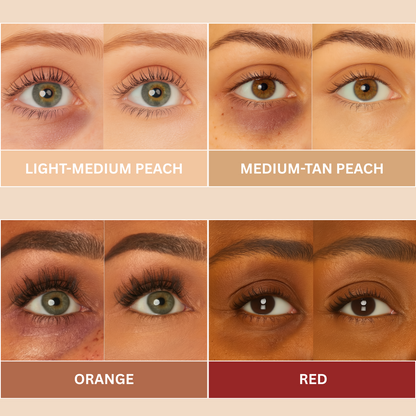 Severa™ Radiant Eye Corrector